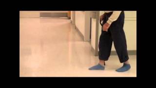 Right Foot Drop in Ambulating Patient  NEJM [upl. by Digdirb356]