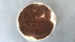 Aspergillus niger on SDA [upl. by Orodisi]