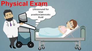 Topic 25 Premature Rupture of Membranes [upl. by Aros]