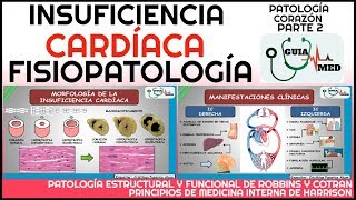 INSUFICIENCIA CARDÍACA FISIOPATOLOGÍA  GuiaMed [upl. by Sivrup]