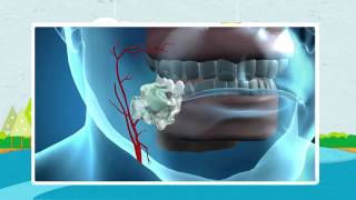 How Nicorette Works [upl. by Ingamar510]