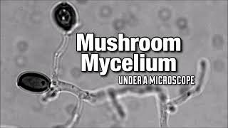 Mushroom Mycelium Under a Microscope [upl. by Ayatan]