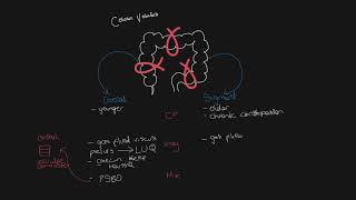 Know your caecal volvulus from sigmoid volvulus [upl. by Yatnoed]