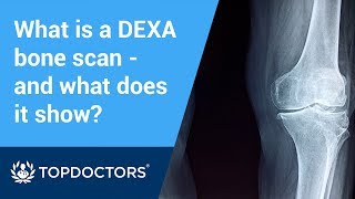 What is a DEXA bone scan and what does it show [upl. by Sherline]