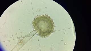 Aspergillus niger explained [upl. by Enial219]