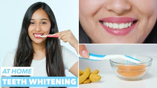 Easy Teeth Whitening at Home [upl. by Besse]