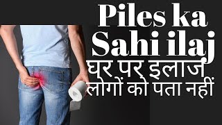 Piles treatment at home in Hindi  Bavasir ka ilaj [upl. by Ecnarrat]