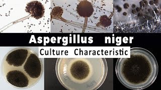 Aspergillus niger Culture Characteristic [upl. by Aracot432]