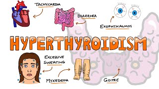 What is Thyroid Disease HealthSketch [upl. by Schwing453]