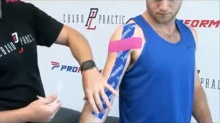 How to Apply PF Performance Tape  Bicep Tendon [upl. by Weissmann]