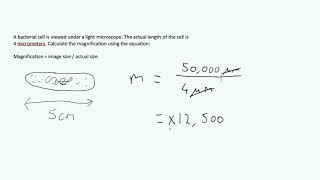 Microscopes amp Magnification  Exam Question AQA GCSE Biology [upl. by Claudian643]