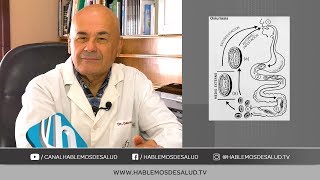 PARASITOSIS INTESTINAL  DR JORGE GAUNA [upl. by Auqinihs227]