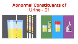 Analysis of Abnormal Urine  Abnormal Urine Constituents Practical Part I  Biochemistry Practical [upl. by Ries]