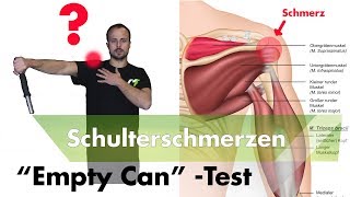 Schulterimpingement Testen  Supraspinatussehne Entzündet [upl. by Platto]