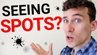 Eye Floaters  7 Reasons You See Spots in Your Vision [upl. by Atirak]