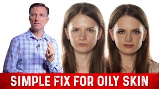 How To Fix Oily Skin With Simple Hack – Dr Berg [upl. by Bondy]