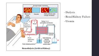 Disorders of Excretory System  Haemodialysis Artificial Kidney  Biology Class 11NEET [upl. by Hnoj]