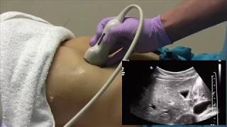 How I do it Ultrasound of the Abdomen [upl. by Avram573]