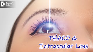 All about PHACO Eye Surgery  Procedue Explained by Expert  Dr Sriram Ramalingam  Doctors Circle [upl. by Jethro169]