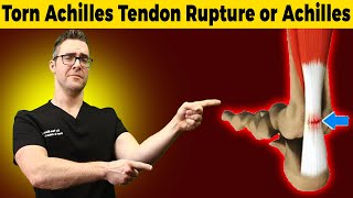 Torn Achilles Tendon Rupture or Achilles Tendonitis HOW TO TELL [upl. by Ainaled]