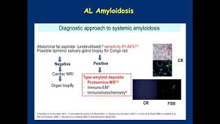 Light Chain AL Amyloidosis Diagnosis and Treatment [upl. by Euginimod538]