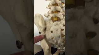 Rhizotomy of the SacroIliac Joint [upl. by Akessej]