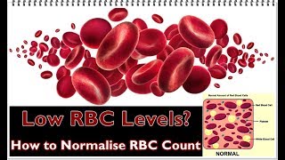 Low RBC Levels – Causes Symptoms Treatment [upl. by Mei]