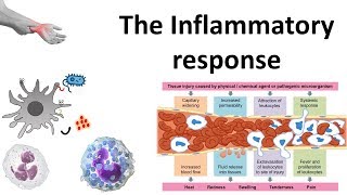 The Inflammatory response [upl. by Yrot]