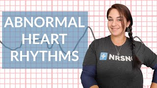 Cardiac Glycosides amp Antidysrhythmic Class III  Pharmacology  Cardiovascular  LevelUpRN [upl. by Nimra]