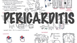 Assessing Lesion Severity in Coronary Angiography [upl. by Trebloc]