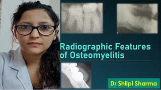 Osteomyelitis  Meaning Causes amp its Treatment  Dr Gururaj S Puranik [upl. by Craner]