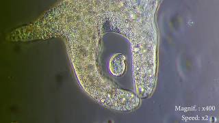 Amoeba eats paramecia  Amoebas lunch   Amoeba Endocytosis  Phagocytosis Part 1  👌 [upl. by Wolram]