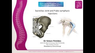 Sacroiliac Joint Injections and prolotherapy [upl. by Launamme]