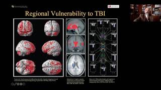 Anatomy of the Brain  Dissectible Model [upl. by Skyla618]