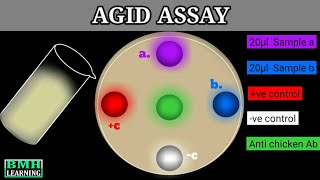 Agar Gel Immunodiffusion Assay  AGID Assay [upl. by Llechtim]