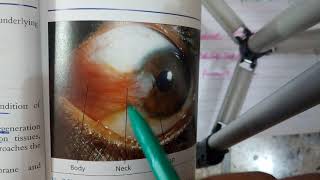 CONJUNCTIVA general structure quick review in easy way [upl. by Swanhilda]