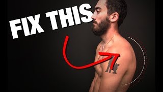 How to Fix Rounded Shoulders GONE IN 4 STEPS [upl. by Dilaw]