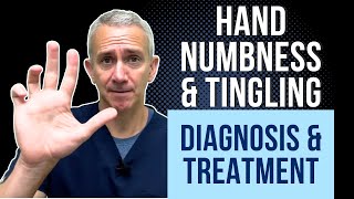 Hand Numbness amp Tingling Diagnosis amp Treatment [upl. by Laforge]