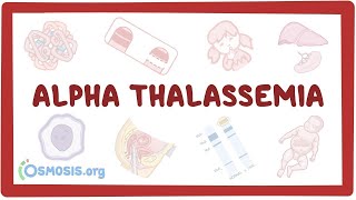 Alphathalassemia  an Osmosis Preview [upl. by Avert]