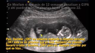 ¿Es legal abortar en México  QueAlguienMeExplique [upl. by Alaster674]