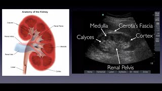 POCUS  Basic Renal Ultrasound [upl. by Adnaloj]