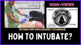 Intubation Extubation 37 [upl. by Egarton]