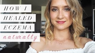 How I Healed Eczema Naturally  My Story [upl. by Sykleb]