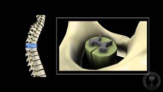 Neuroanatomy  The spinal cord [upl. by Mattie572]