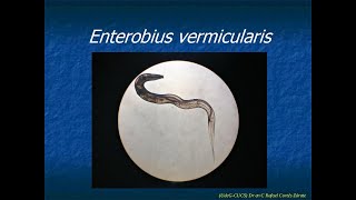 Enterobius vermicularis [upl. by Brout597]