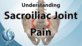 Understanding Sacroiliac Joint Pain [upl. by Roshelle22]