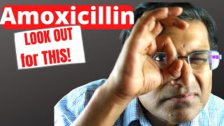 What is Amoxicillin used for 12 valuable TIPS [upl. by Annwahsal444]