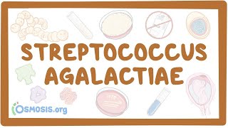 Streptococcus agalactiae group B strep  an Osmosis Preview [upl. by Asiuol]