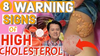 Weight Loss and Diet Tips Part 1  Doctor Willie Ong Health Blog 8 [upl. by Nisay]