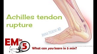 Achilles Tendon Rupture [upl. by Nywrad]